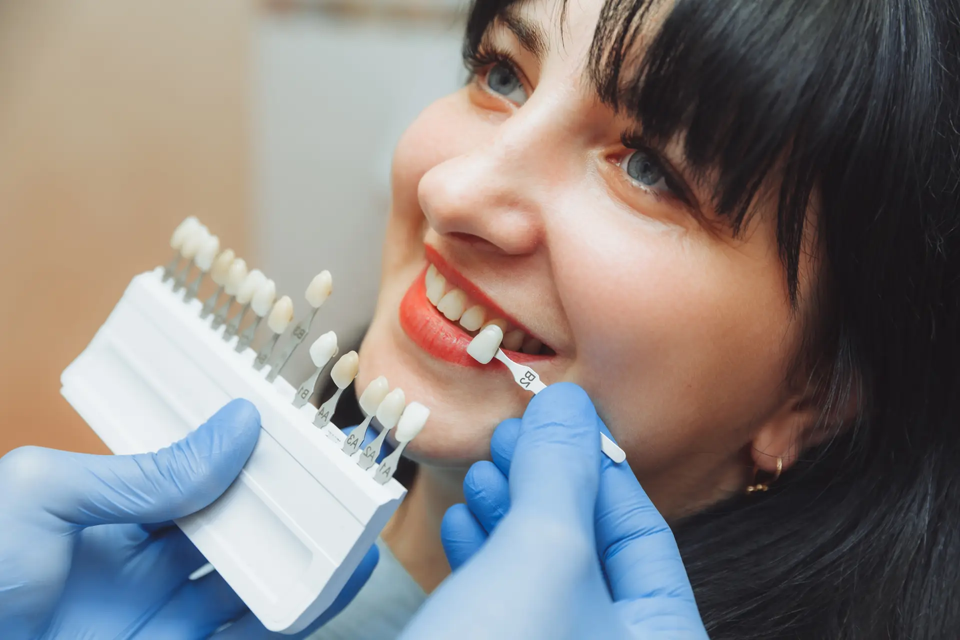 Dentist comparing porcelain veneer shades with a patient at Olympic Park Smiles Dental in Calgary