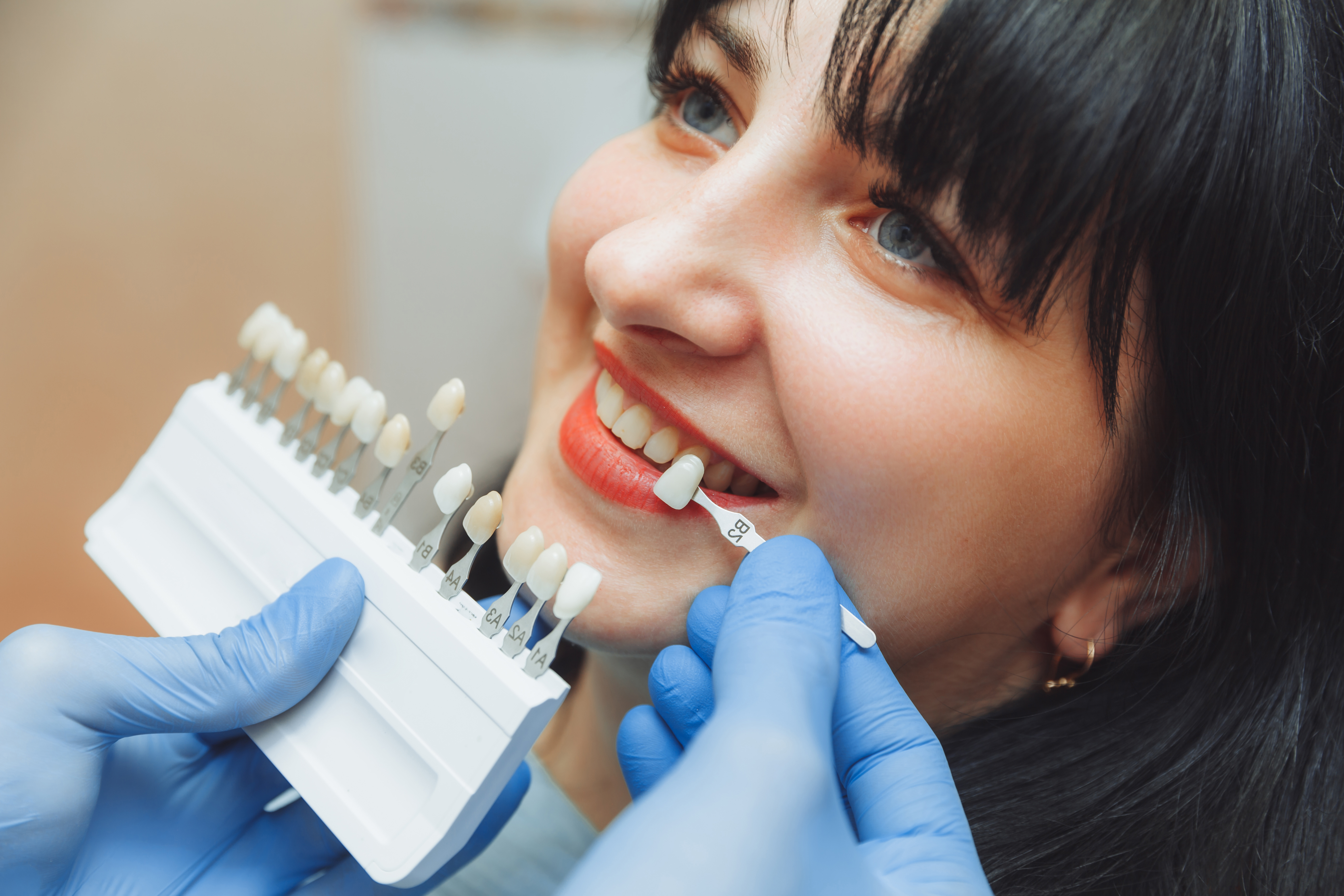 Porcelain Veneers